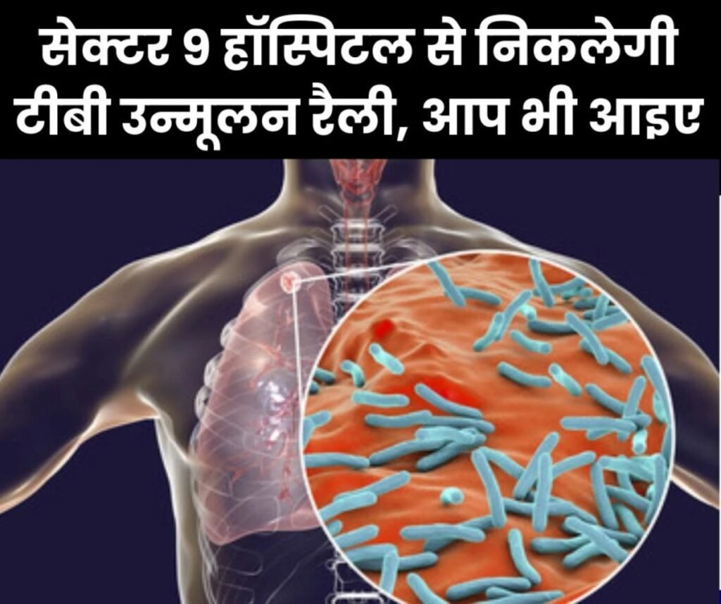 सेक्टर 9 हॉस्पिटल से निकलेगी टीबी उन्मूलन रैली, पढ़िए डिटेल