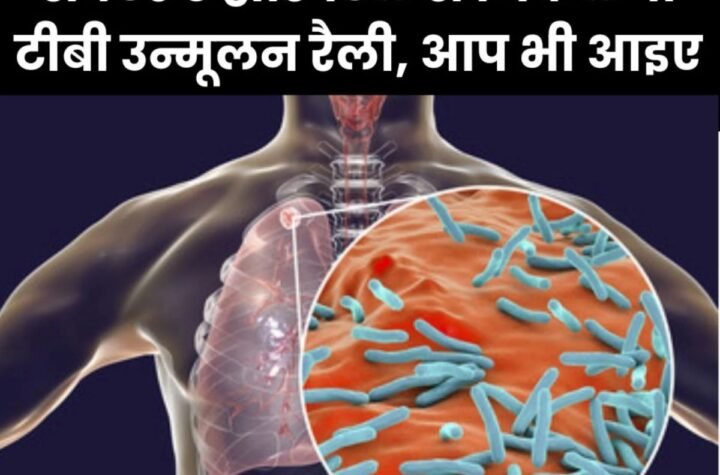 सेक्टर 9 हॉस्पिटल से निकलेगी टीबी उन्मूलन रैली, पढ़िए डिटेल